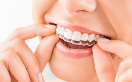 Straighten Your Smile with Expert Invisalign Burbank Services Today