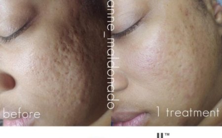 Facials Seattle Rejuvenating skin care treatments for glowing results