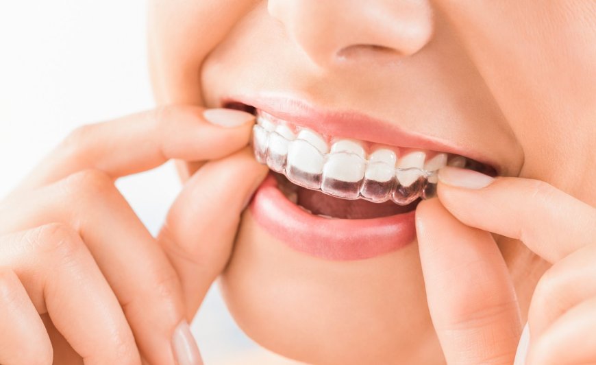 Straighten Your Smile with Expert Invisalign Burbank Services Today