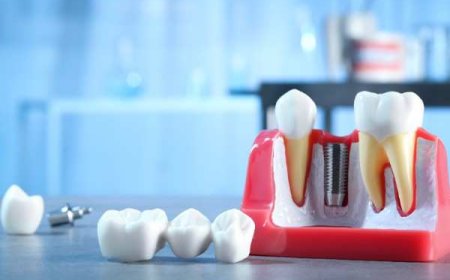 Helping You Achieve Your Dream Smile in Gillingham