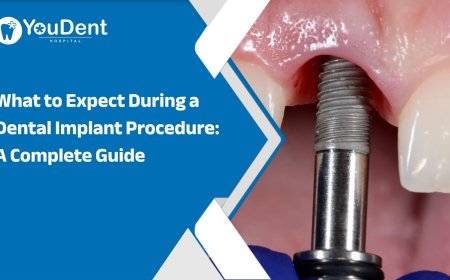 What to Expect During a Dental Implant Procedure: A Complete Guide